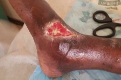 image-before-after-3-weeks