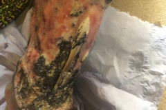 image-sure-wound-care-2020-1