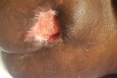 image-sure-wound-care-2020-10