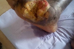 image-sure-wound-care-2020-12