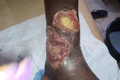 image-sure-wound-care-2020-13