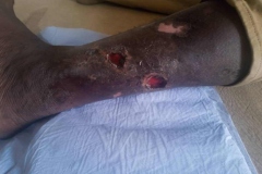 image-sure-wound-care-2020-15