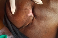 image-sure-wound-care-2020-17