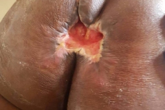 image-sure-wound-care-2020-19