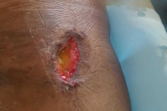 image-sure-wound-care-2020-2