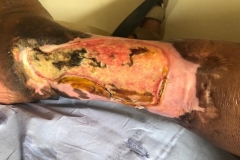 image-sure-wound-care-2020-21