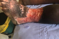 image-sure-wound-care-2020-22