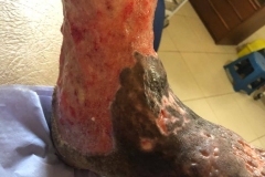 image-sure-wound-care-2020-23