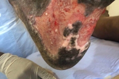image-sure-wound-care-2020-24