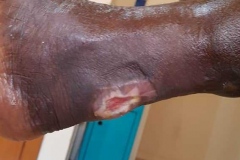 image-sure-wound-care-2020-4