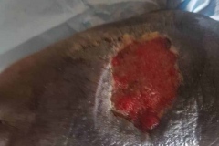 image-sure-wound-care-2020-5