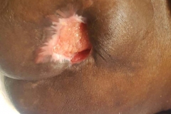 image-sure-wound-care-2020-9