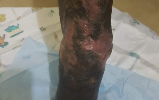 After a few weeks of treatment