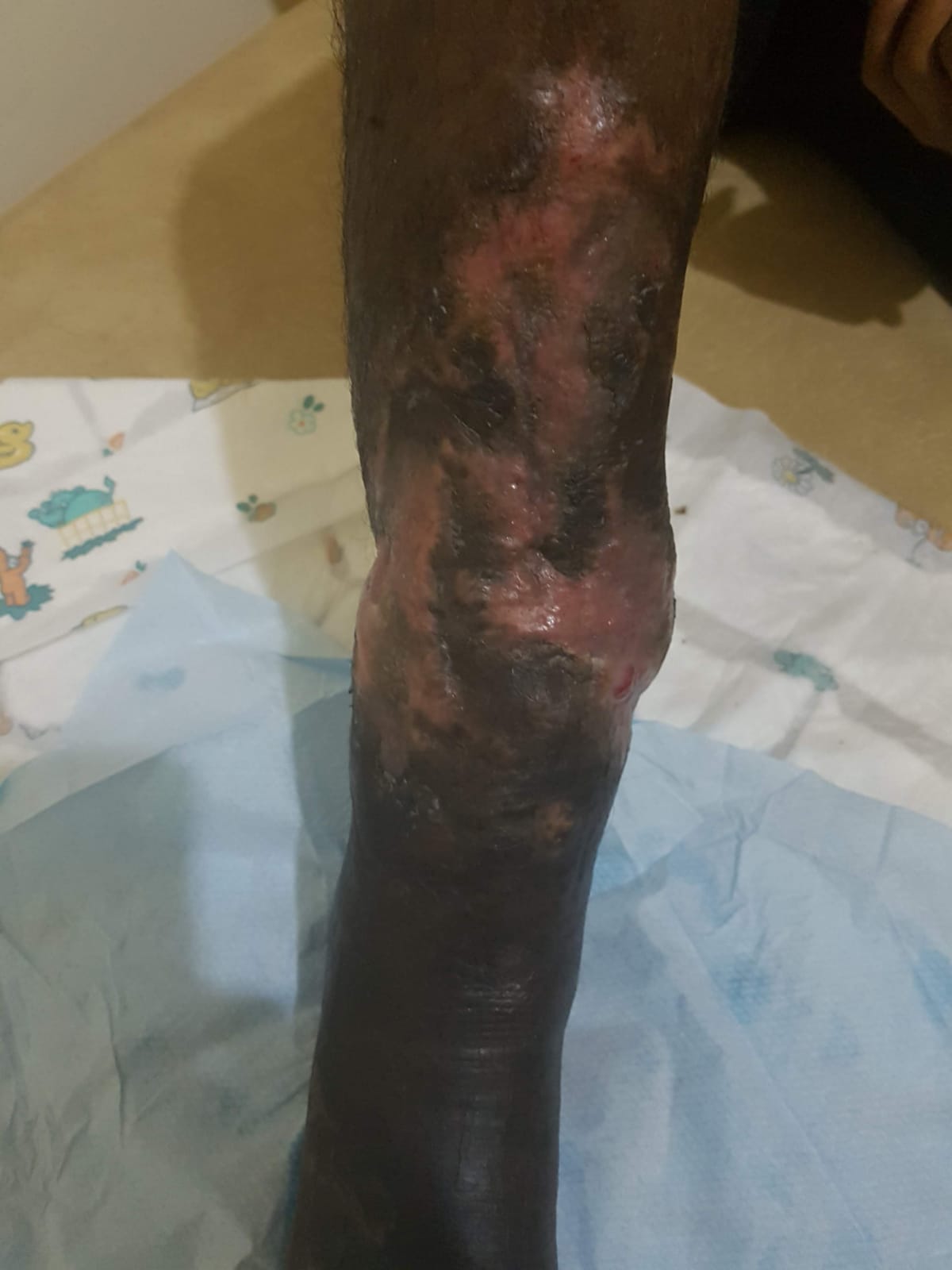 After a few weeks of treatment